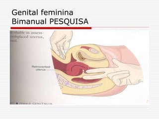 Genital feminina
Bimanual PESQUISA
 