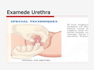 Examede Urethra
 