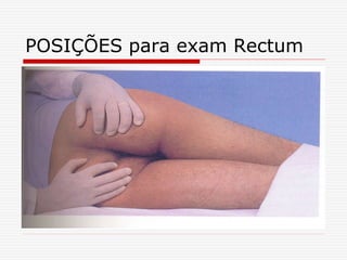 POSIÇÕES para exam Rectum
 