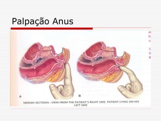 Palpação Anus
 