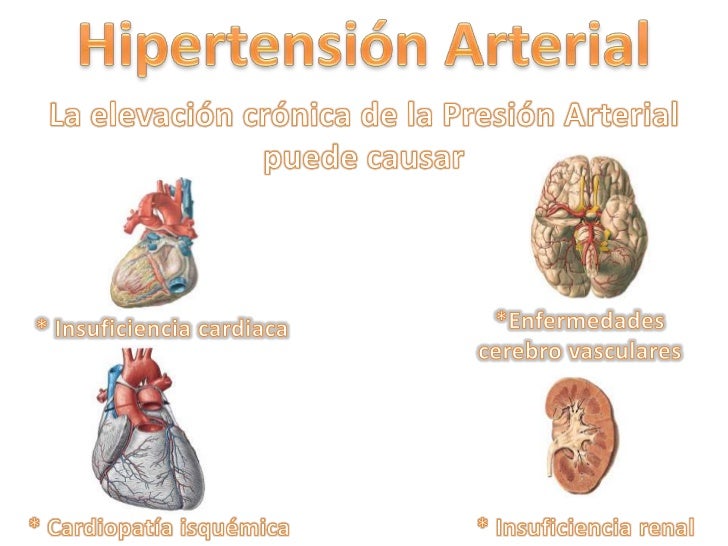 Hipertensin Arterial Wikipedia La Enciclopedia Libre