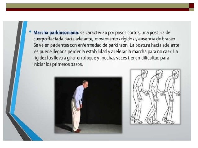 Las pastillas para el adelgazamiento comprar en vetname en