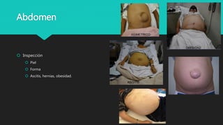 Abdomen
 Inspección
 Piel
 Forma
 Ascitis, hernias, obesidad.
 