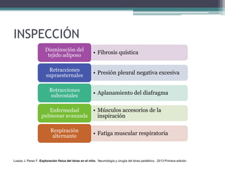 INSPECCIÓN
• Fibrosis quística
Disminución del
tejido adiposo
• Presión pleural negativa excesiva
Retracciones
supraesternales
• Aplanamiento del diafragma
Retracciones
subcostales
• Músculos accesorios de la
inspiración
Enfermedad
pulmonar avanzada
• Fatiga muscular respiratoria
Respiración
alternante
Loaiza J. Perez F. Exploración física del tórax en el niño. Neumología y cirugía del tórax pediátrico. 2013 Primera edición
 