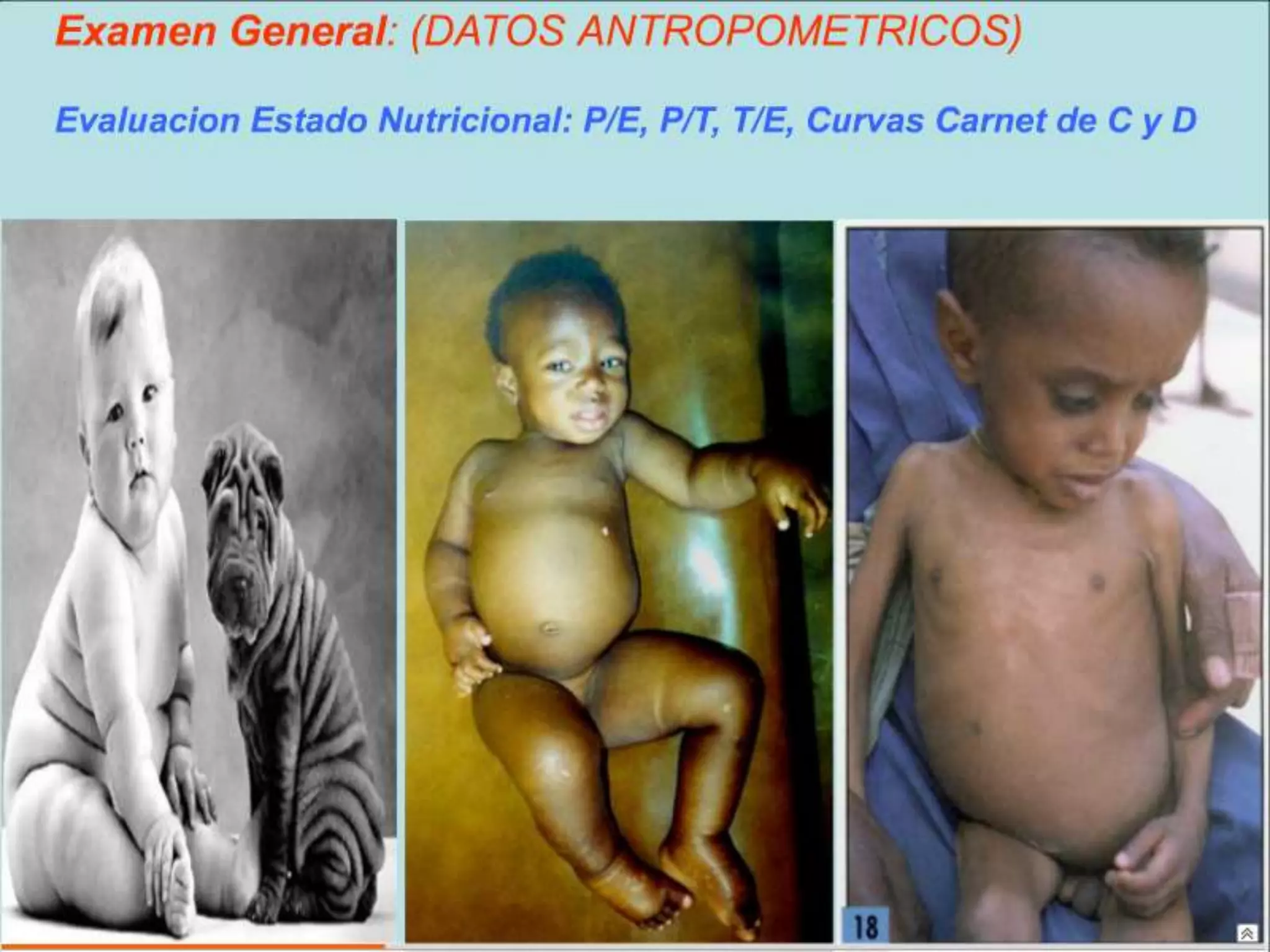 Semiología Pediatrica