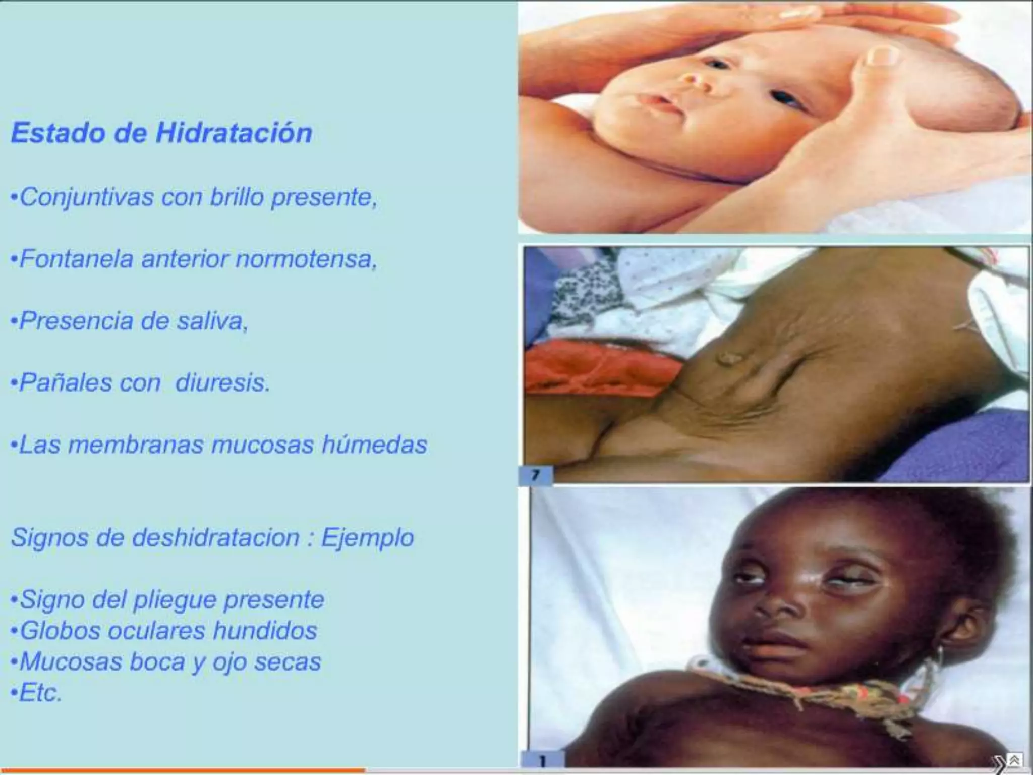 Semiología Pediatrica