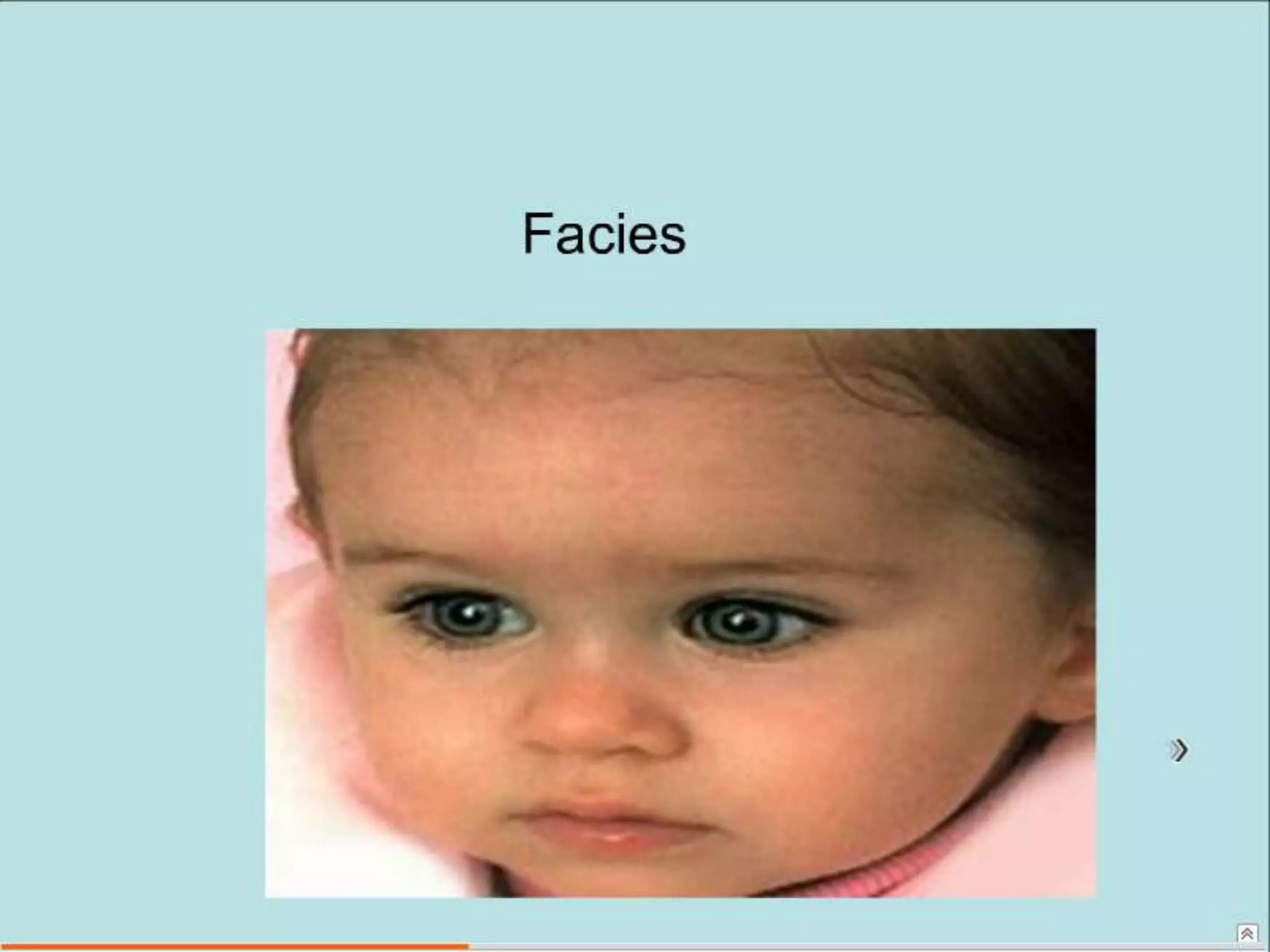 Semiología Pediatrica