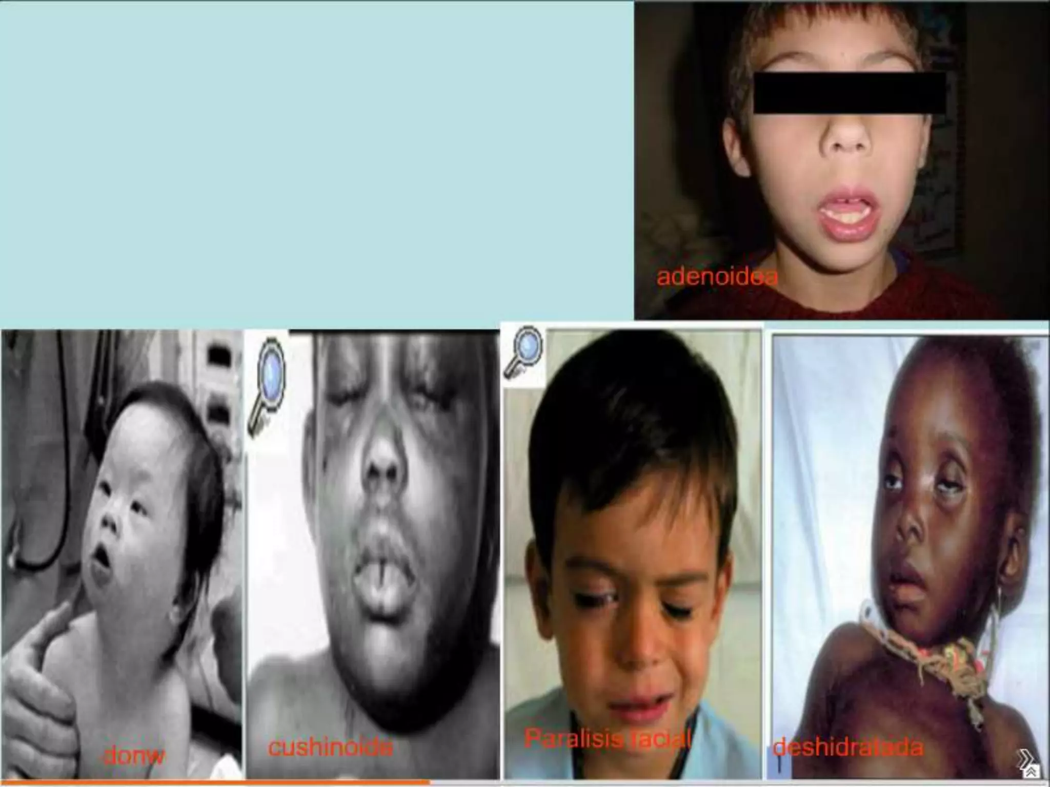 Semiología Pediatrica