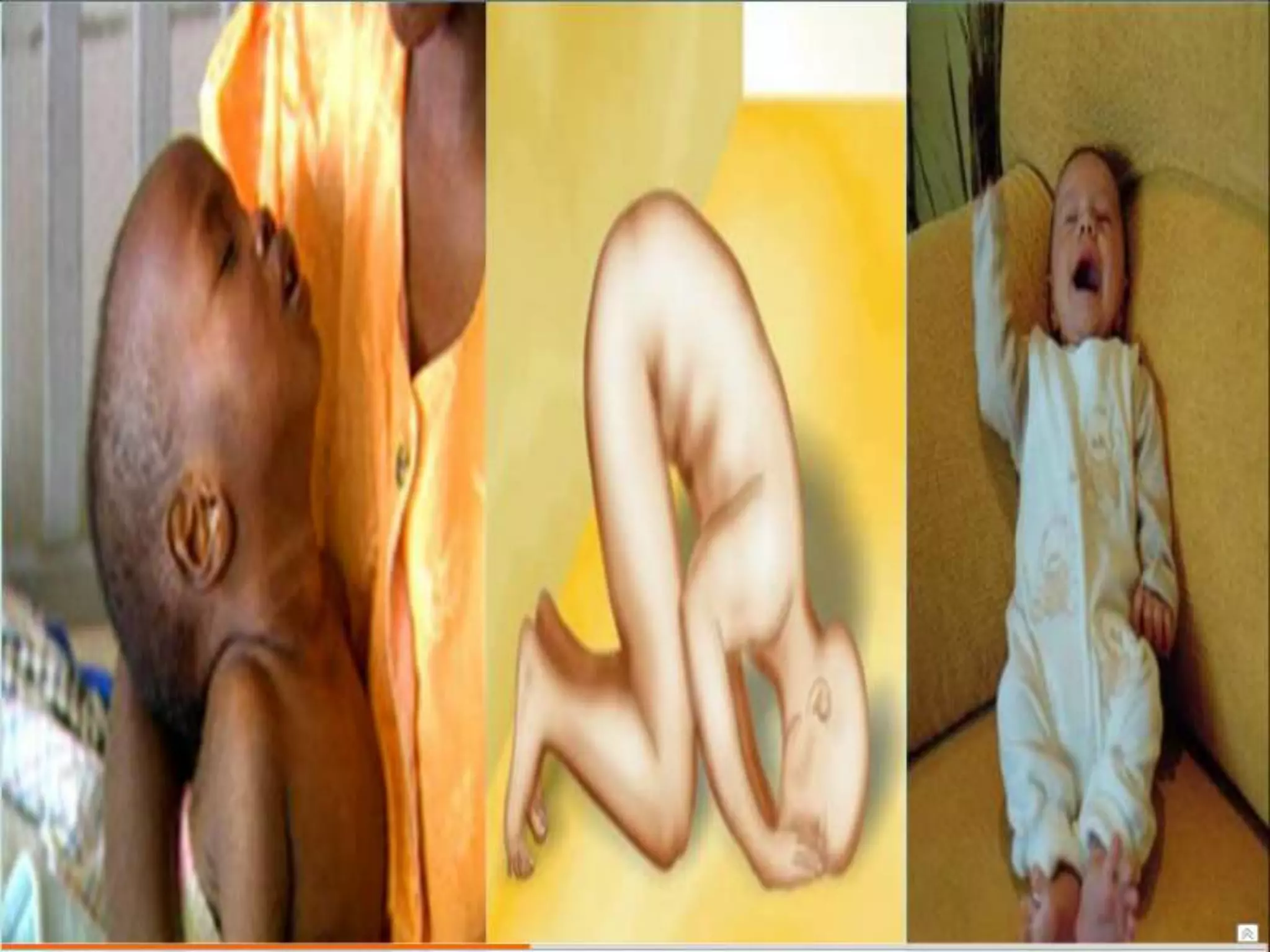 Semiología Pediatrica