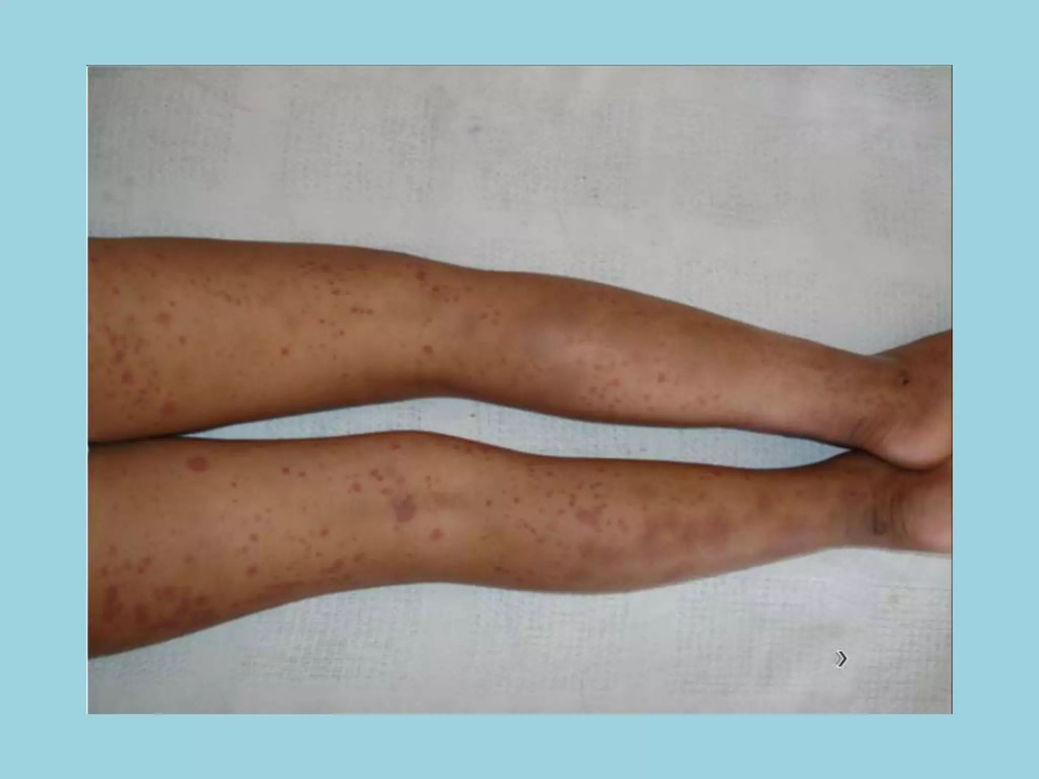 Semiología Pediatrica