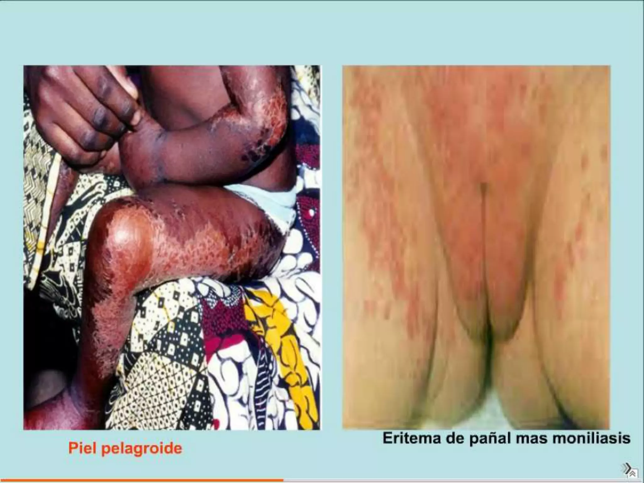 Semiología Pediatrica