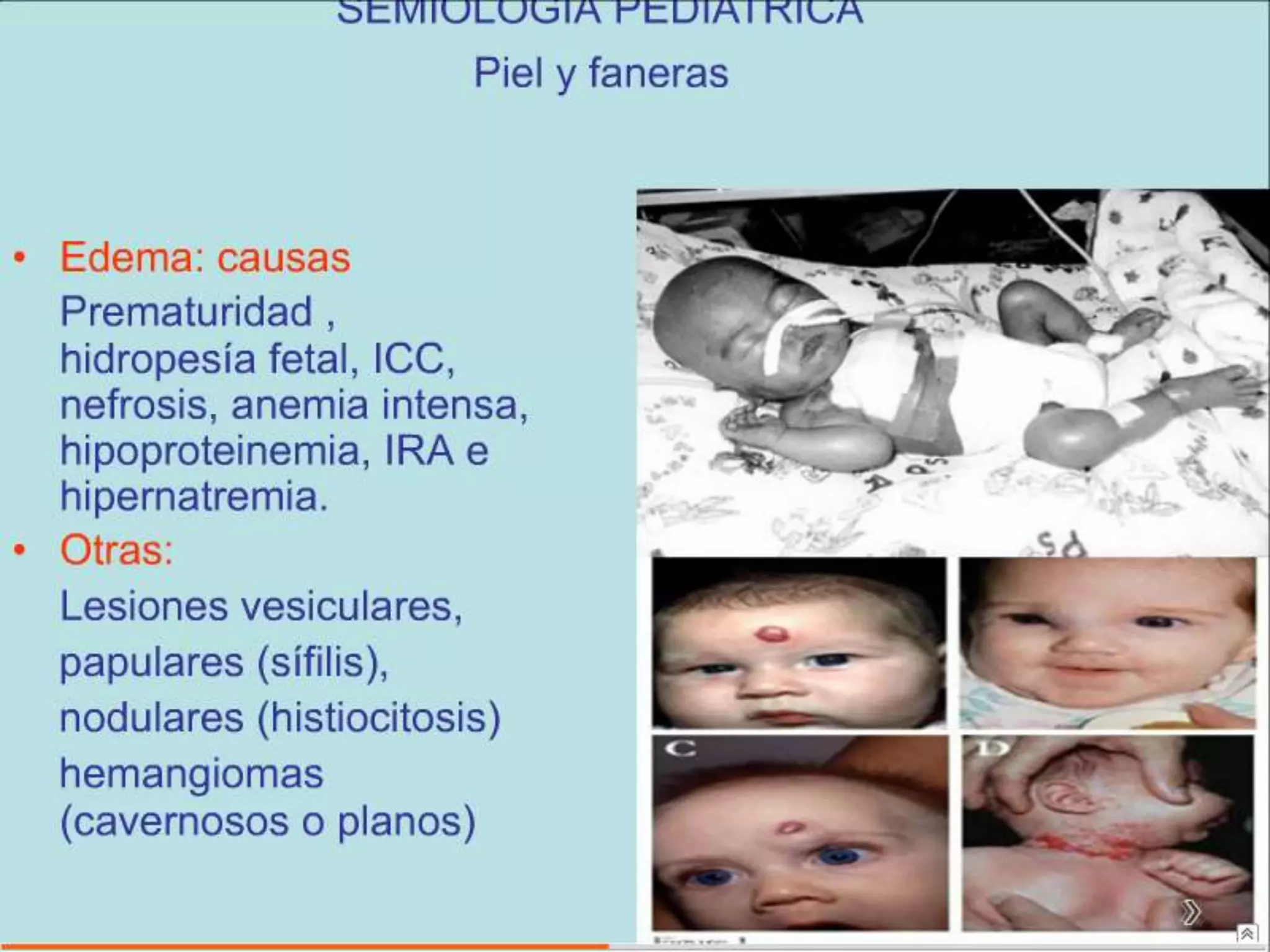 Semiología Pediatrica