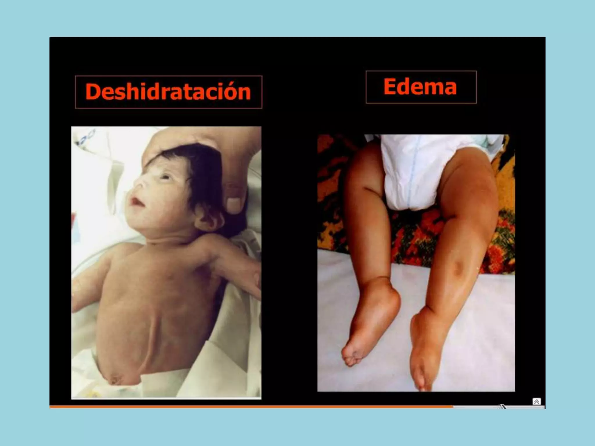 Semiología Pediatrica