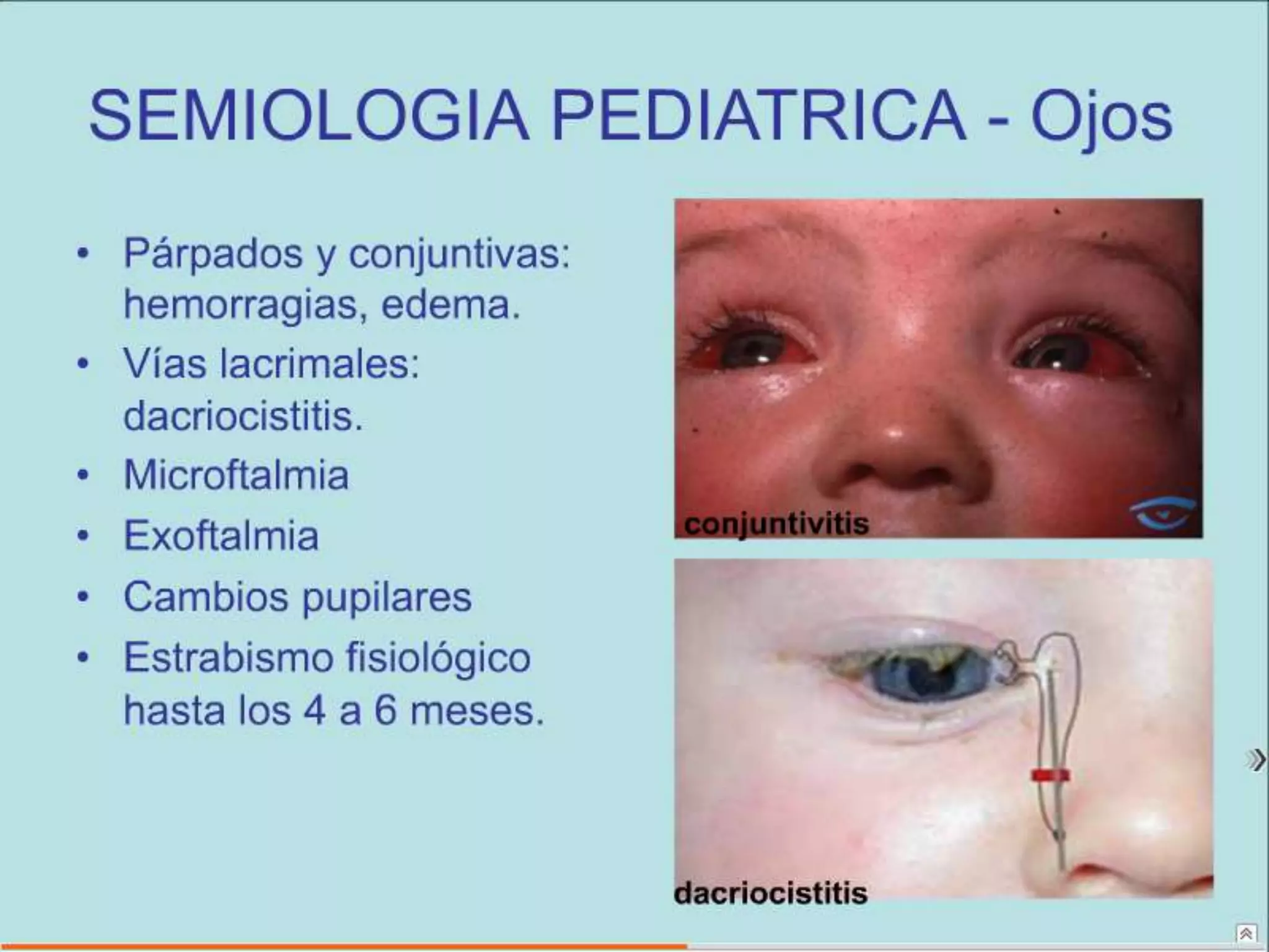 Semiología Pediatrica