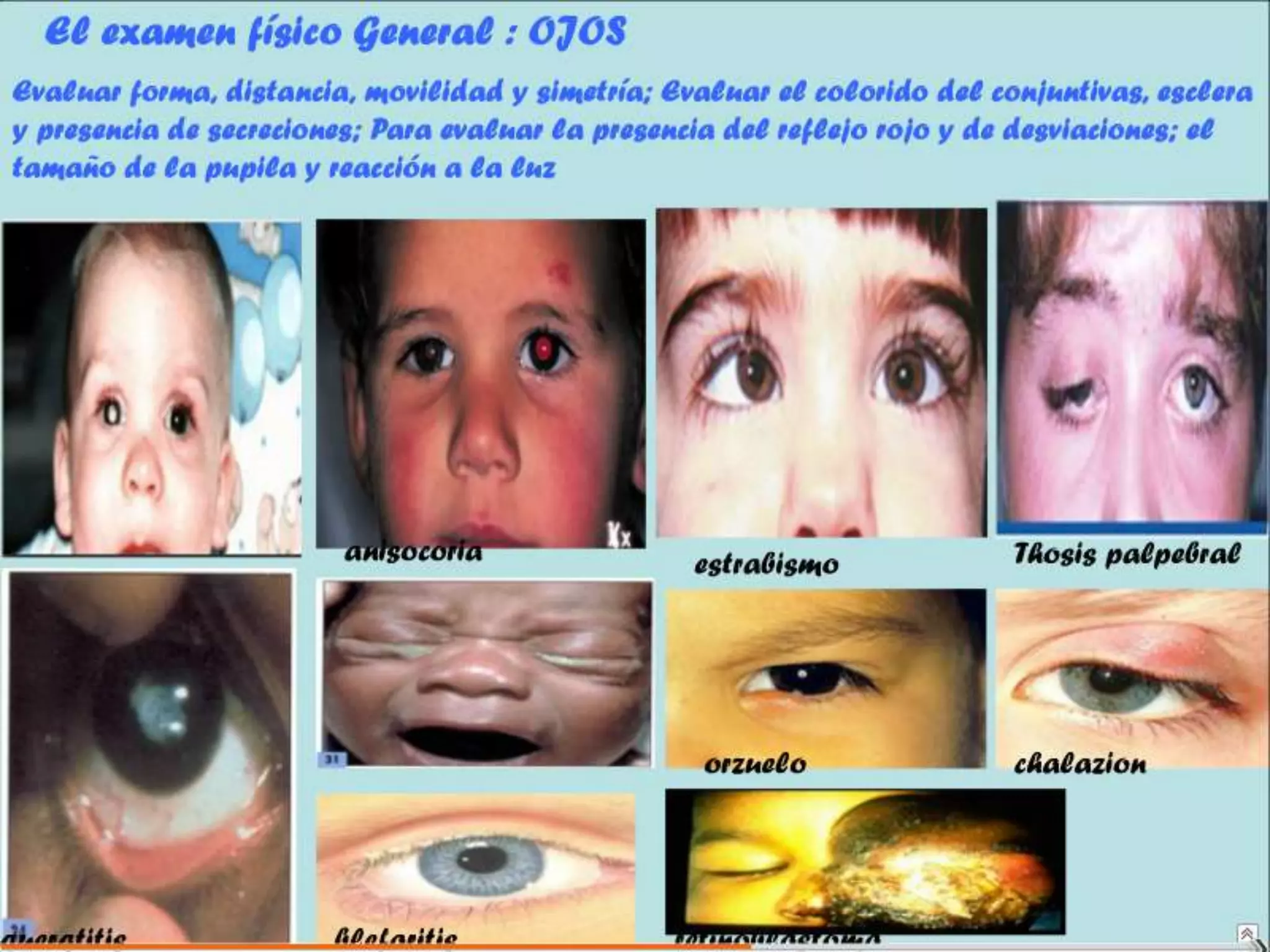 Semiología Pediatrica