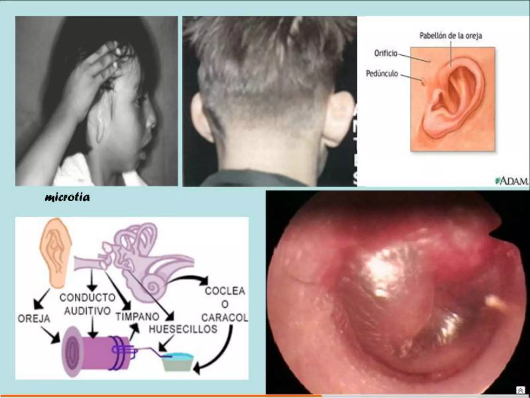 Semiología Pediatrica