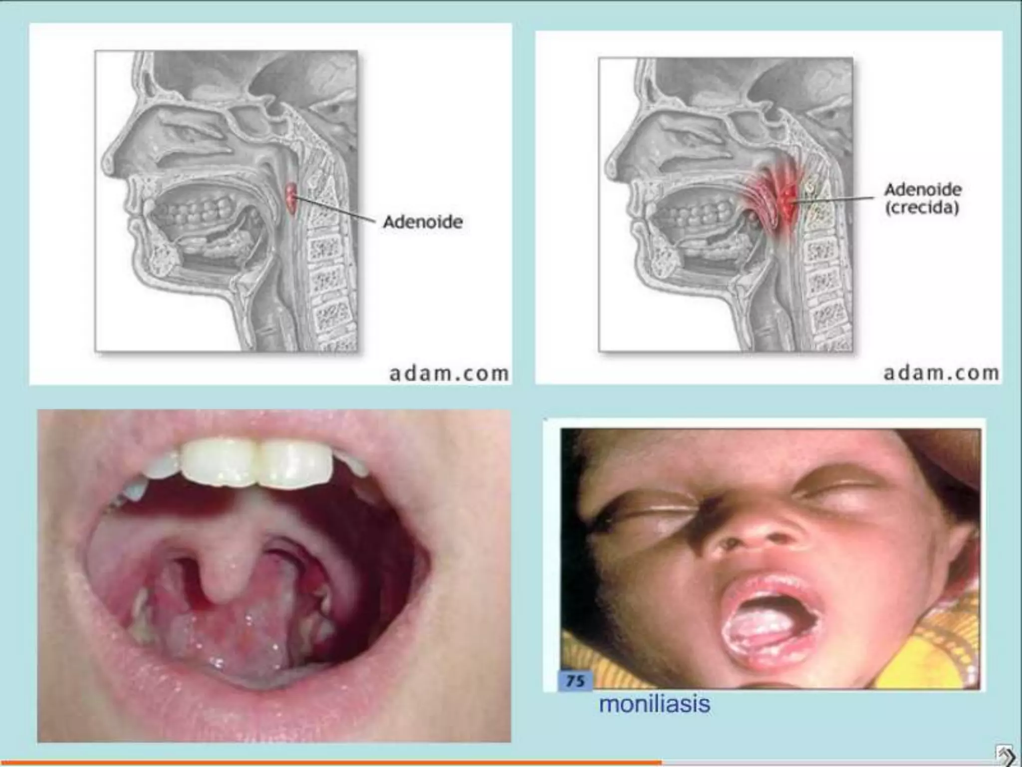 Semiología Pediatrica