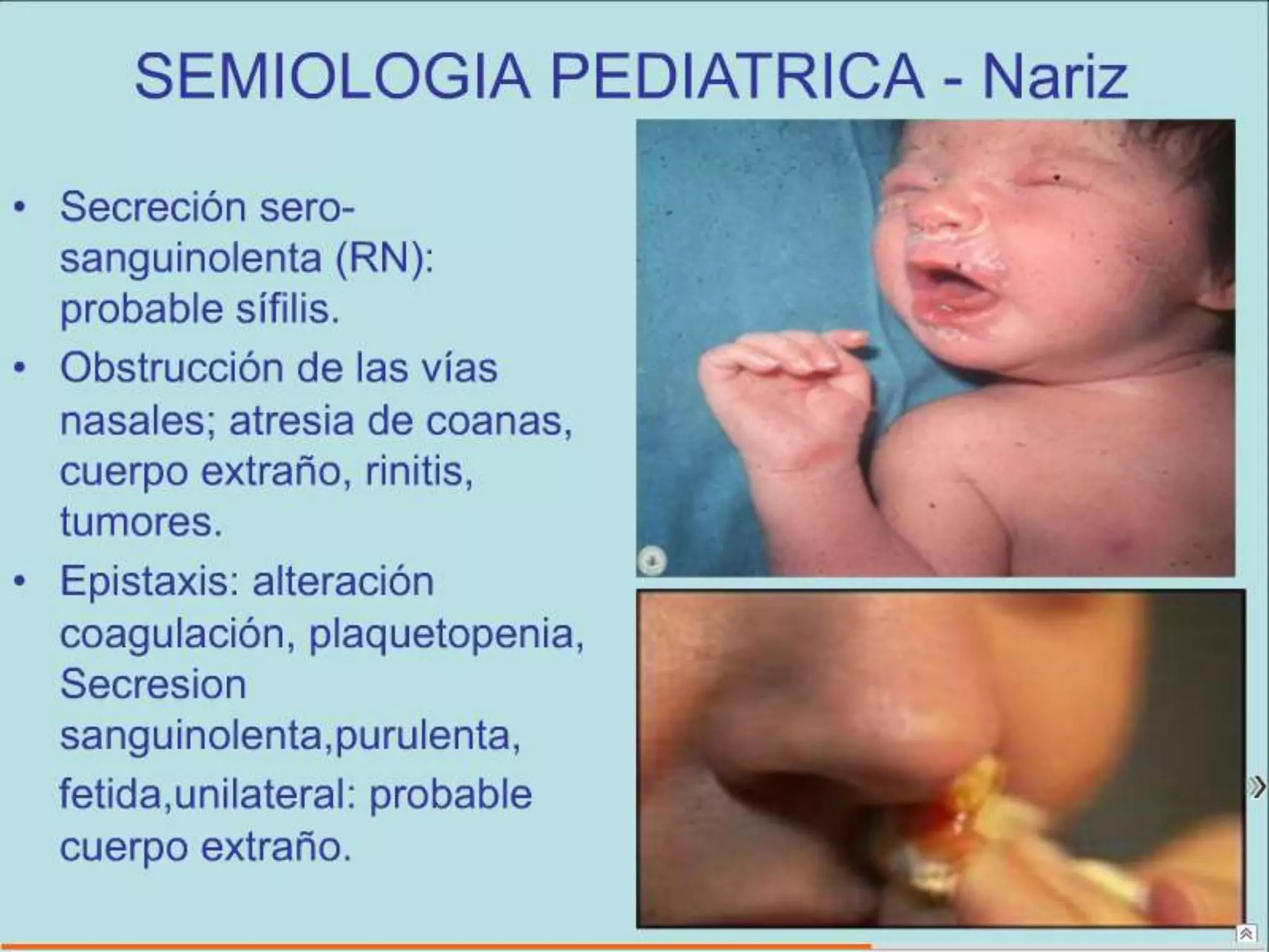 Semiología Pediatrica