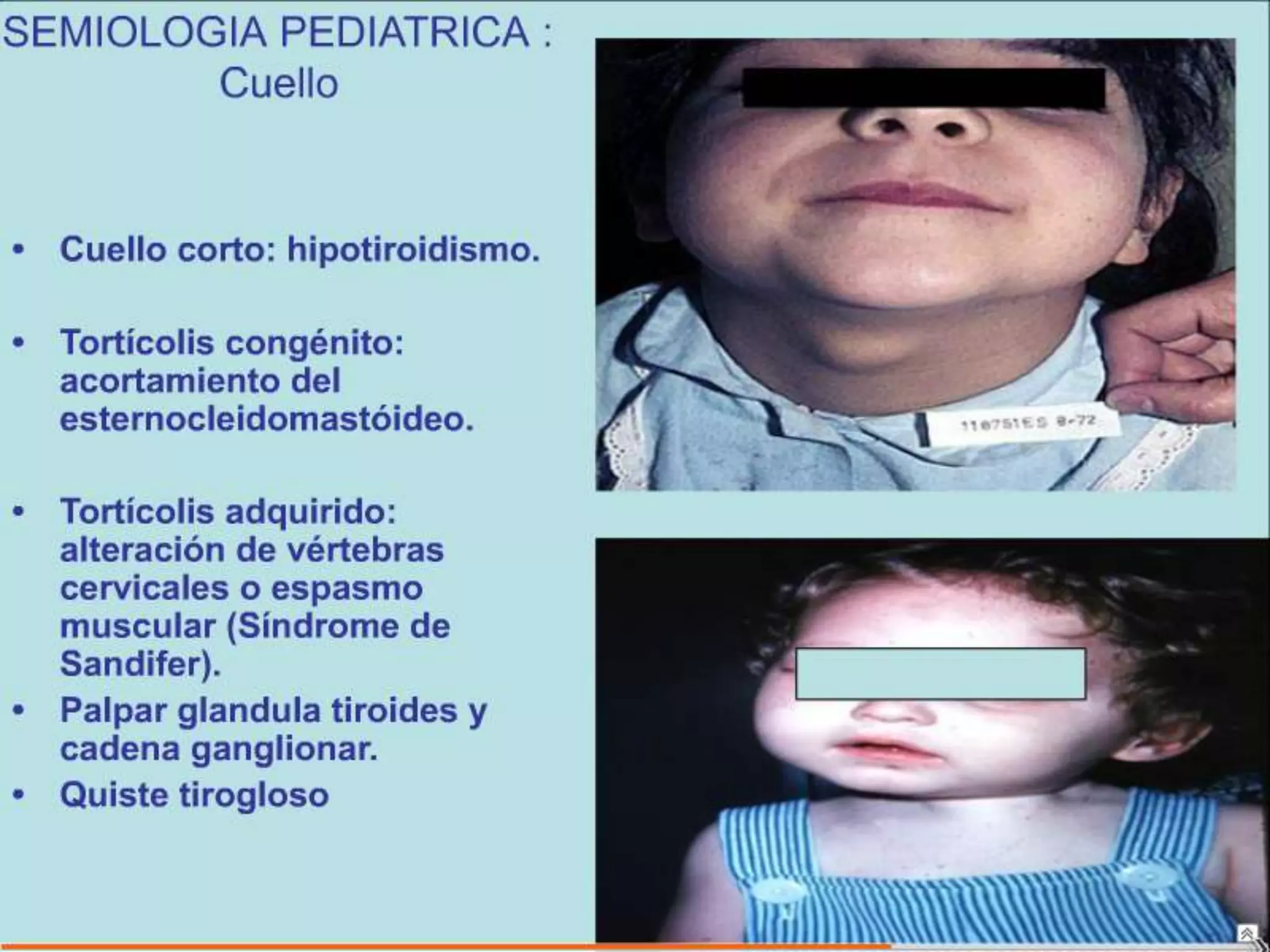 Semiología Pediatrica