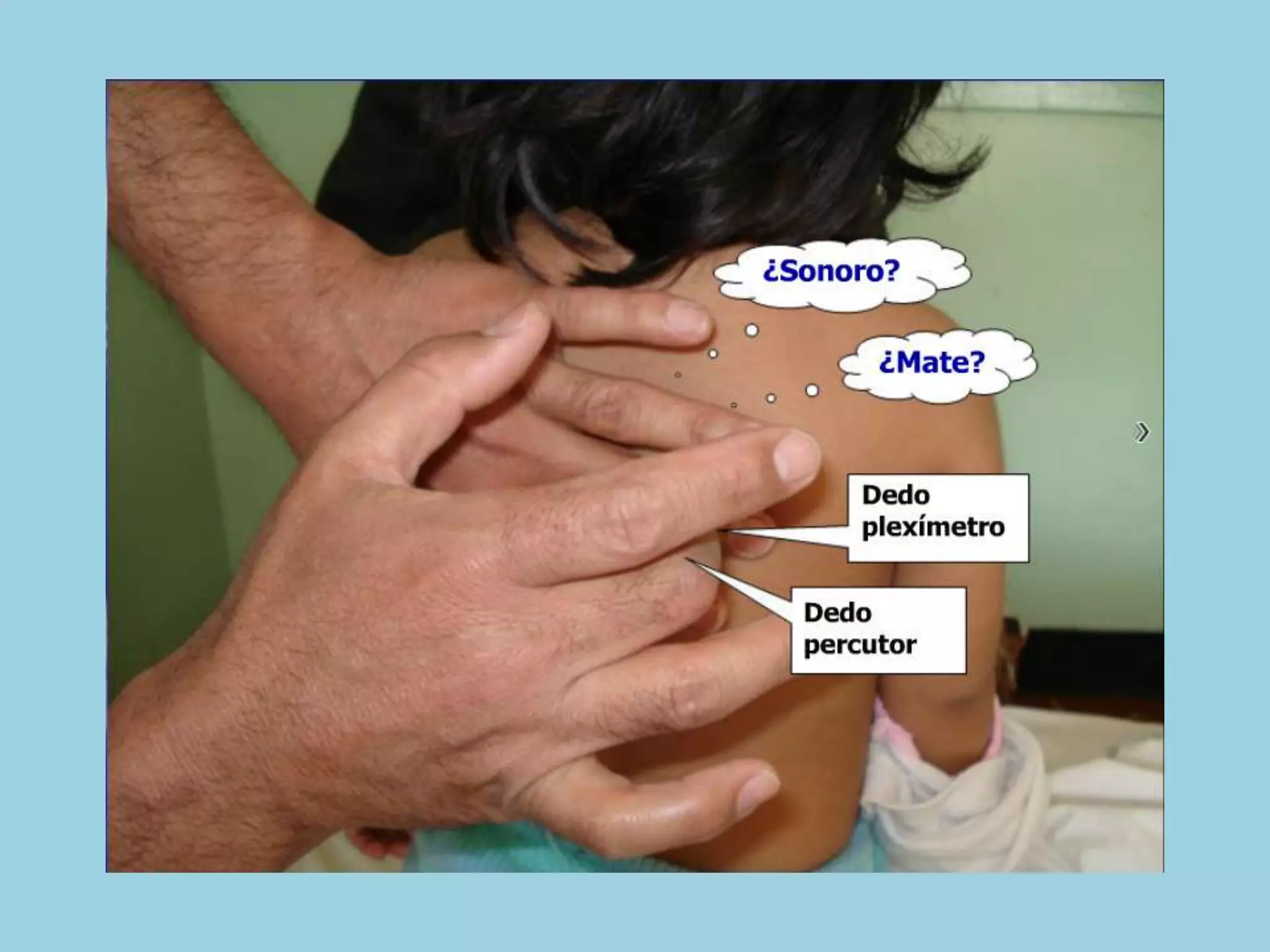 Semiología Pediatrica