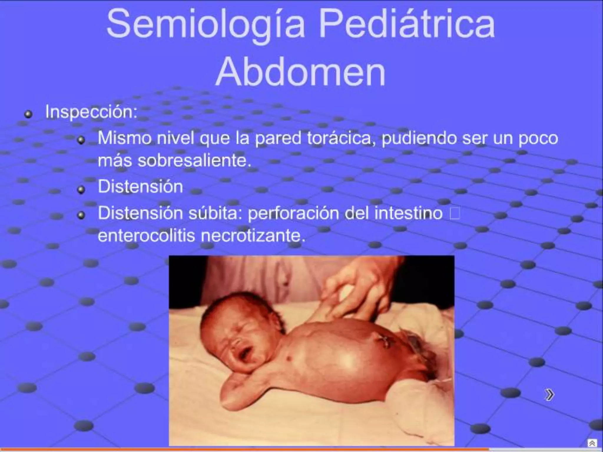 Semiología Pediatrica