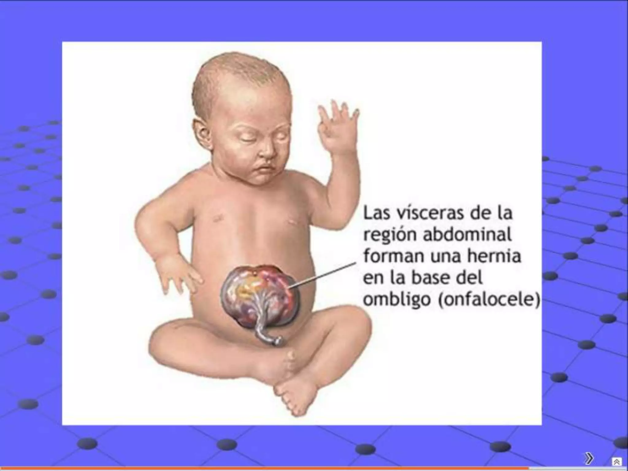 Semiología Pediatrica