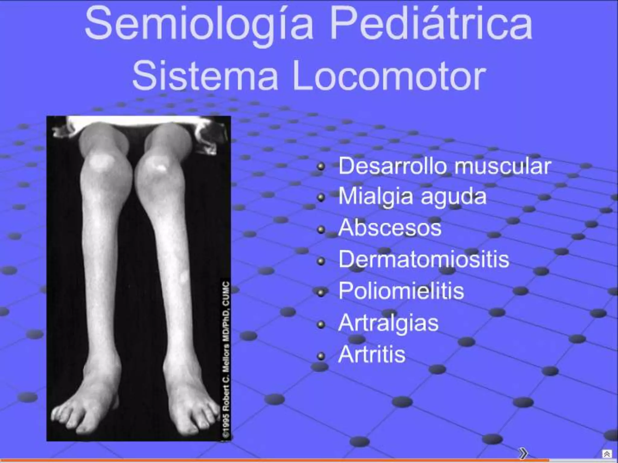 Semiología Pediatrica