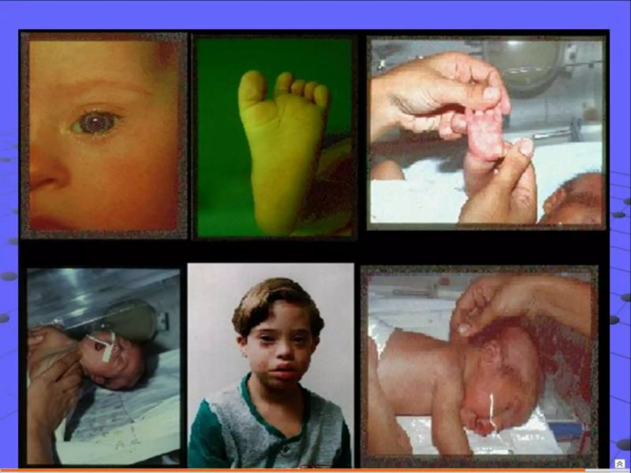 Semiología Pediatrica