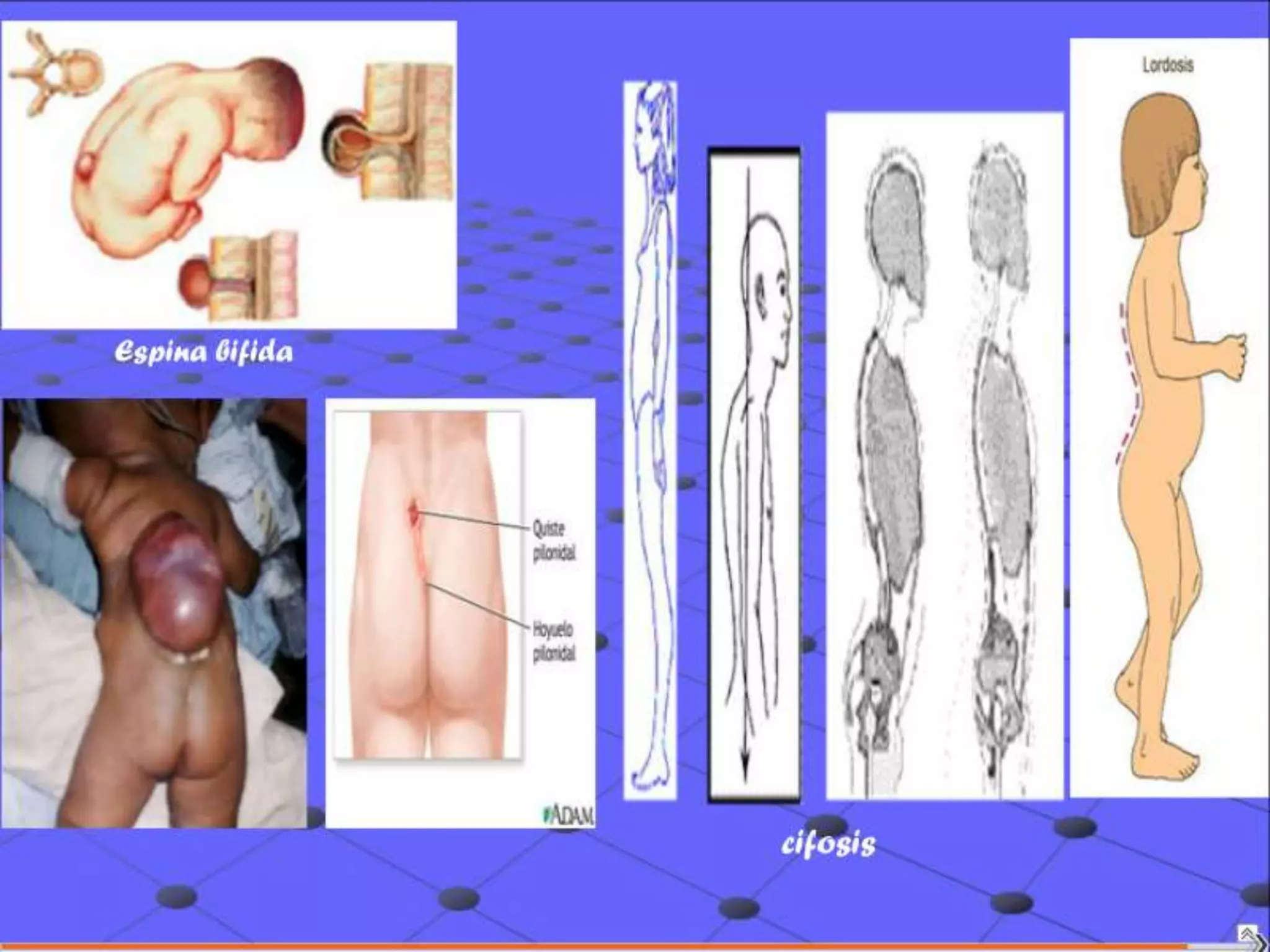 Semiología Pediatrica