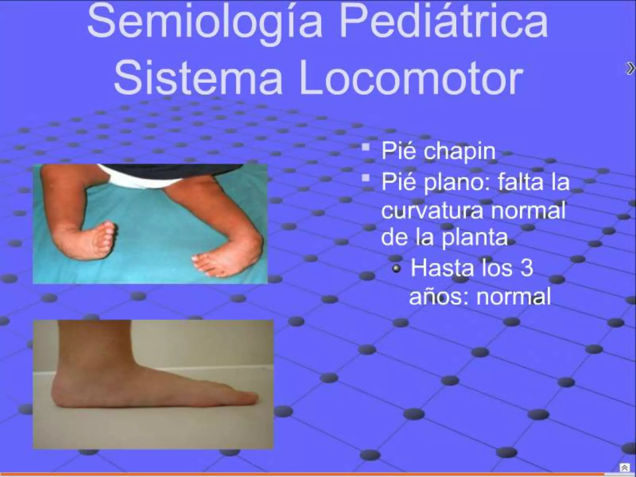 Semiología Pediatrica