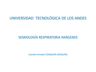 UNIVERSIDAD  TECNOLÓGICA DE LOS ANDES SEMIOLOGÍA RESPIRATORIA IMÁGENES Lizandro Amador COAQUIRA COAQUIRA 