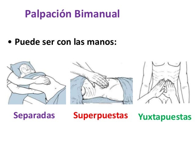 Descripción de los hallazgos palpatorios.
•Frente a una tumoración u órgano palpable, se deben describir las
siguientes ca...