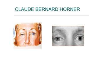 CLAUDE BERNARD HORNER
 