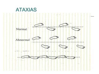 ATAXIAS
 