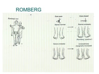 ROMBERG
 