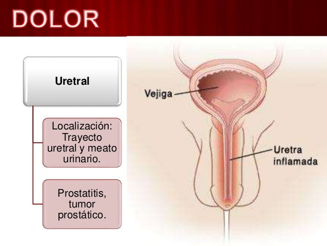 Si puede ser la psoriasis sobre los dedos de los pies