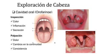 Exploración de Cabeza
 Cavidad oral (Orofaringe)
Inspección
 Color
 Inflamación
 Secreción
Palpación
 Dolor
 Cambios en la continuidad
 Consistencia
 