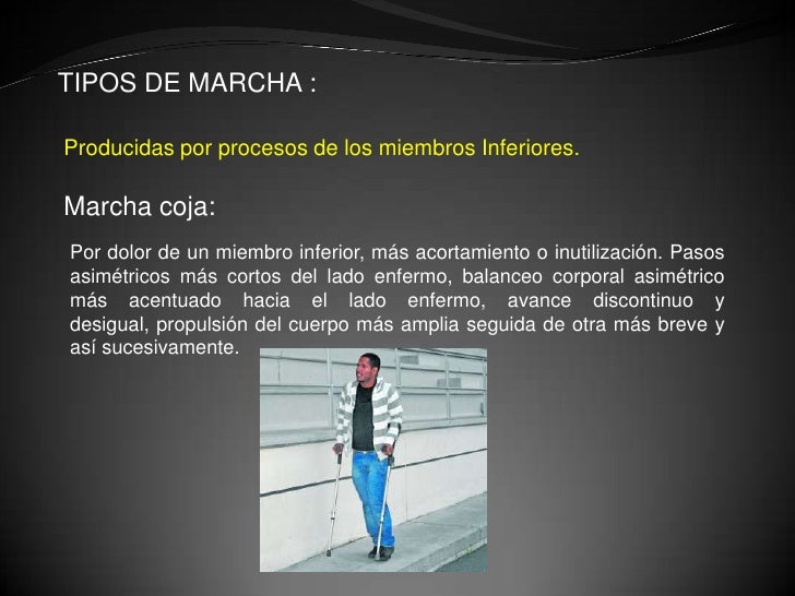 De sus que dimensiones se considera un pequeño miembro