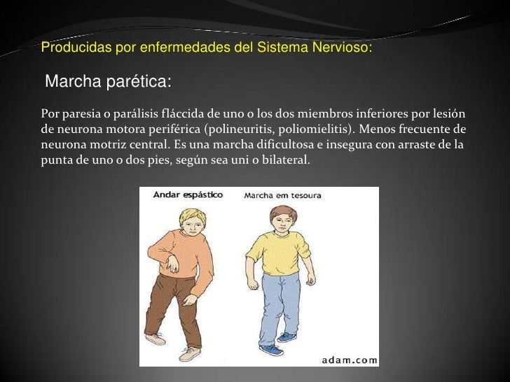 Semiologia. actitud, biotipo y marcha.