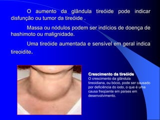 O aumento da glândula tireóide pode indicar
disfunção ou tumor da tireóide .
      Massa ou nódulos podem ser indícios de doença de
hashimoto ou malignidade.
       Uma tireóide aumentada e sensível em geral indica
tireoidite.



                               Crescimento da tireóide
                               O crescimento da glândula
                               tireoidiana, ou bócio, pode ser causado
                               por deficiência do iodo, o que é uma
                               causa freqüente em países em
                               desenvolvimento.
 