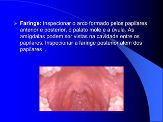    Faringe: Inspecionar o arco formado pelos papilares
    anterior e posterior, o palato mole e a úvula. As
    amígdalas podem ser vistas na cavidade entre os
    papilares. Inspecionar a faringe posterior alem dos
    papilares .
 