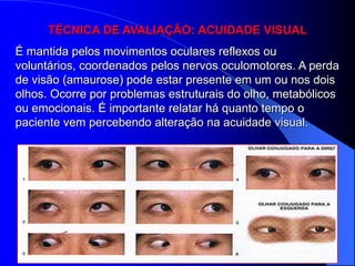 TÉCNICA DE AVALIAÇÃO: ACUIDADE VISUAL
É mantida pelos movimentos oculares reflexos ou
voluntários, coordenados pelos nervos oculomotores. A perda
de visão (amaurose) pode estar presente em um ou nos dois
olhos. Ocorre por problemas estruturais do olho, metabólicos
ou emocionais. É importante relatar há quanto tempo o
paciente vem percebendo alteração na acuidade visual.
 