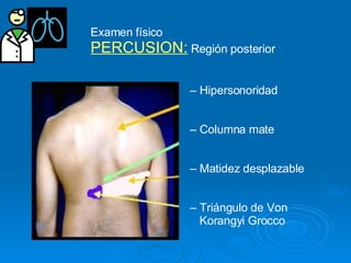 Semiologia De Torax Unssa | PPT