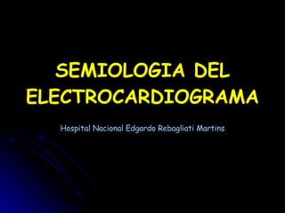 SEMIOLOGIA DEL ELECTROCARDIOGRAMA Hospital Nacional Edgardo Rebagliati Martins 