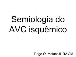 Semiologia do AVC isquêmico Tiago O. Malucelli  R2 CM 