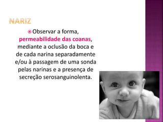  Observar a forma,
permeabilidade das coanas,
mediante a oclusão da boca e
de cada narina separadamente
e/ou à passagem de uma sonda
pelas narinas e a presença de
secreção serosanguinolenta.
 
