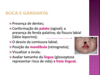  Presença de dentes;
 Conformação do palato (ogival); a
presença de fenda palatina; da fissura labial
(lábio leporino);
 O desvio da comissura labial;
 Posição da mandíbula (retrognatia);
 Visualizar a úvula;
 Avaliar tamanho da língua (glossoptose
representar risco de vida) e freio lingual.
 