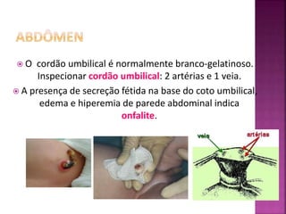  O cordão umbilical é normalmente branco-gelatinoso.
Inspecionar cordão umbilical: 2 artérias e 1 veia.
 A presença de secreção fétida na base do coto umbilical,
edema e hiperemia de parede abdominal indica
onfalite.
 