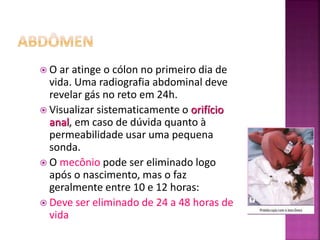  O ar atinge o cólon no primeiro dia de
vida. Uma radiografia abdominal deve
revelar gás no reto em 24h.
 Visualizar sistematicamente o orifício
anal, em caso de dúvida quanto à
permeabilidade usar uma pequena
sonda.
 O mecônio pode ser eliminado logo
após o nascimento, mas o faz
geralmente entre 10 e 12 horas:
 Deve ser eliminado de 24 a 48 horas de
vida
 