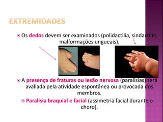  Os dedos devem ser examinados (polidactilia, sindactilia,
malformações ungueais).
 A presença de fraturas ou lesão nervosa (paralisias) será
avaliada pela atividade espontânea ou provocada dos
membros.
 Paralisia braquial e facial (assimetria facial durante o
choro).
 